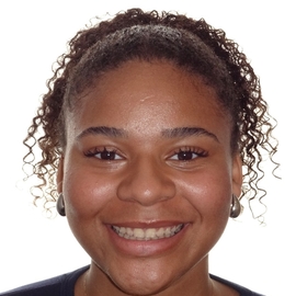 ChloeLeemrijse1
