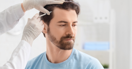 Casting homme ou femme atteint d’alopécie pour tournage vidéo témoignage