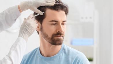 Casting homme ou femme atteint d’alopécie pour tournage vidéo témoignage